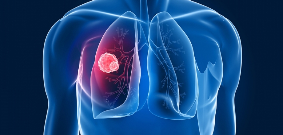 Referans Hastanesi - GÖĞÜS HASTALIKLARI